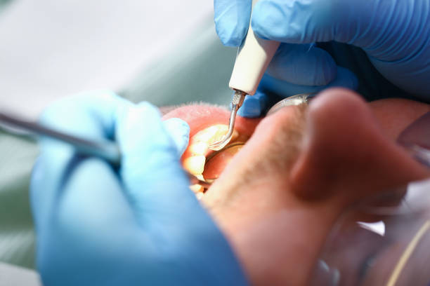Best Emergency Gum Treatment in Eagle, NE