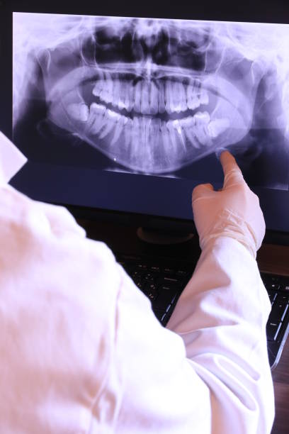 Best Emergency Tooth Extraction in Eagle, NE